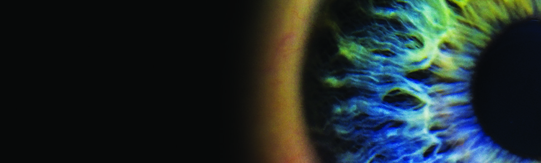 Close-up of eye