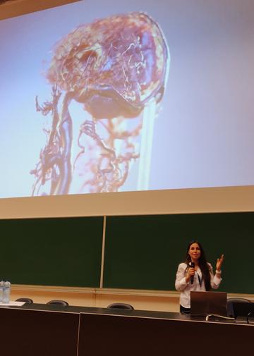 large picture of brain, projected onto a screen, selena milanovic at the bottom talking into a microphone.